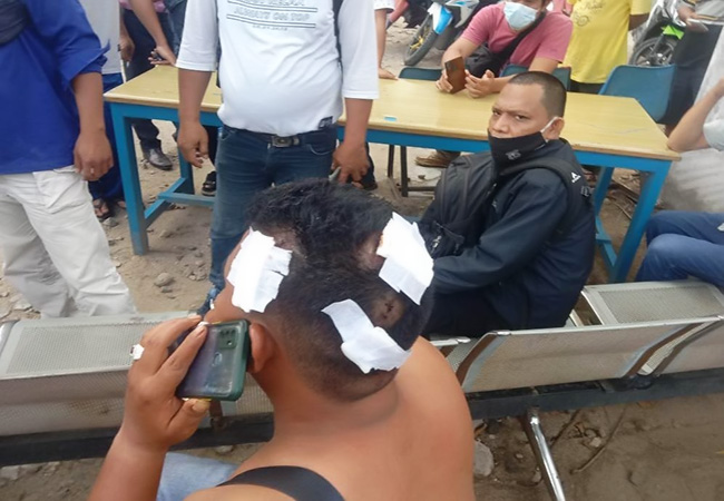 Insiden Berdarah Mewarnai Lokasi Proyek Pasar Nauli Kota Sibolga