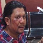 Terkait Pemukulan Wartawan di Madina, Ketum FR: Apa sih Kerja Kapolda Sumut? Jangan Tutup Mata