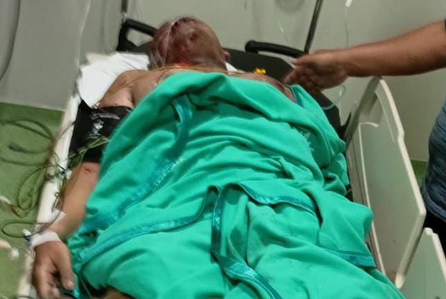 Breaking News! Ledakan Terjadi di Asrama Polisi Sukoharjo, Satu Korban Terluka
