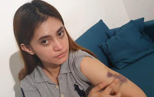 Update Polwan Sekap dan Aniaya Wanita di Pekanbaru